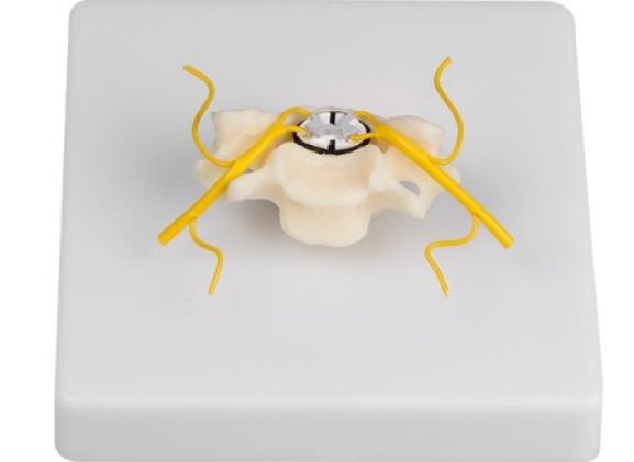 https://mail.jayakelana.co.id/uploads/product/-4067-vertebra-with-spinal-952539f2afe432b_cover.jpg