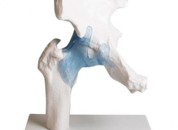 https://mail.jayakelana.co.id/uploads/product/-4553-hip-joint-with-82763c414e2056d_cover.jpg