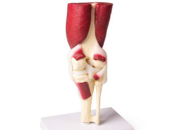 https://mail.jayakelana.co.id/uploads/product/-4662-knee-joint-life-8299968e157feef_cover.jpg
