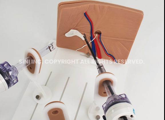 https://mail.jayakelana.co.id/uploads/product/-a-lph-01-laparoscopic-hernia-surgery-7117416c2979294_cover.jpg