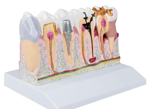 https://mail.jayakelana.co.id/uploads/product/-d250-dental-model-4-74088418ba20bdb_cover.jpg