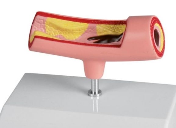 https://mail.jayakelana.co.id/uploads/product/-g241-artery-model-772495449e734f5_cover.jpg