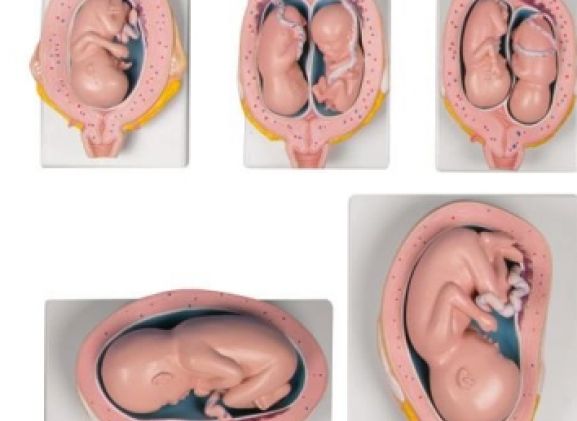 https://mail.jayakelana.co.id/uploads/product/-l204-pregnancy-model-set--3240079c3983ebe_cover.jpg