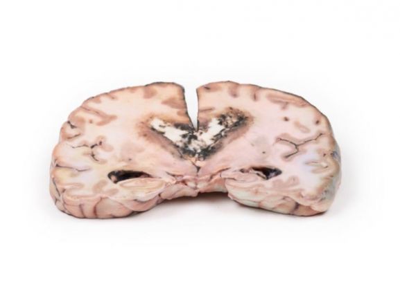 https://mail.jayakelana.co.id/uploads/product/-mp2003-glioma-grade-3-4--15959f8d55a3304_cover.jpg
