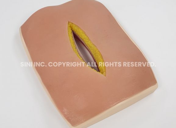https://mail.jayakelana.co.id/uploads/product/-s-afs-01-abdominal-fascia-suture-968431c7eb30eca_cover.jpg