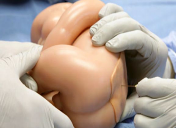 https://mail.jayakelana.co.id/uploads/product/pelatih-bayi-lumbarpunctur-lpb-40--790166142266041_cover.png
