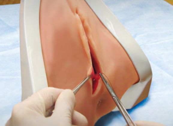 https://mail.jayakelana.co.id/uploads/product/perineal-repair-replaceable-tissue-12948e3954c122f_cover.png